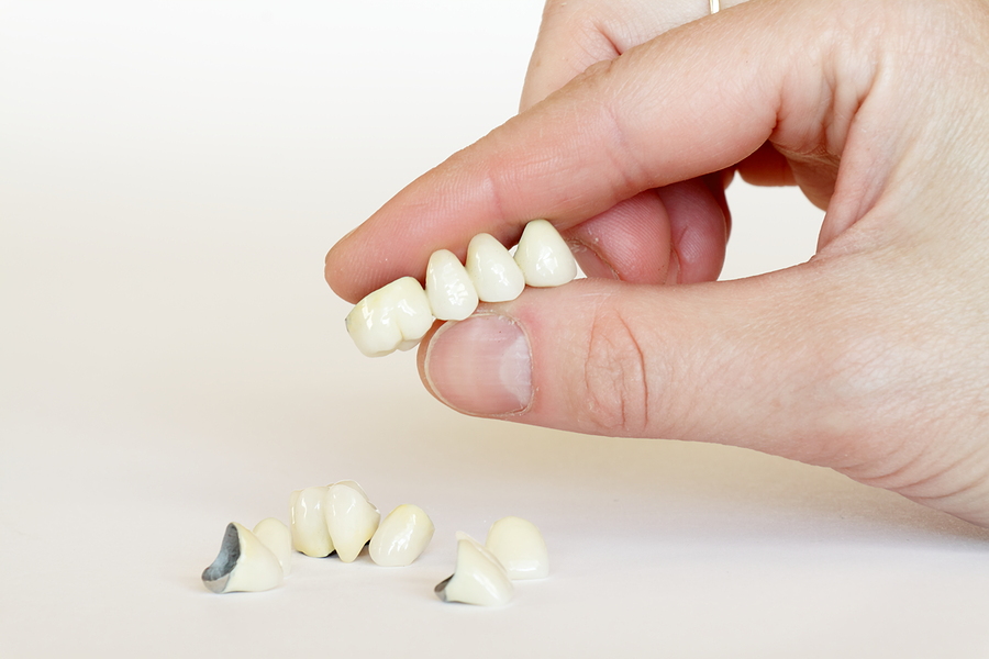 How Do Crowns Help You Attain a Smile Makeover?